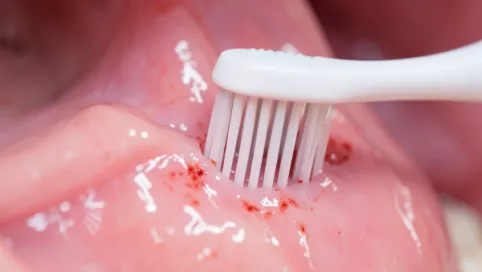 Czy szczoteczka elektryczna niszczy dziąsła