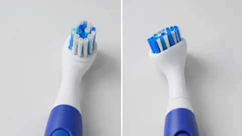 szczoteczka soniczna czy elektryczna